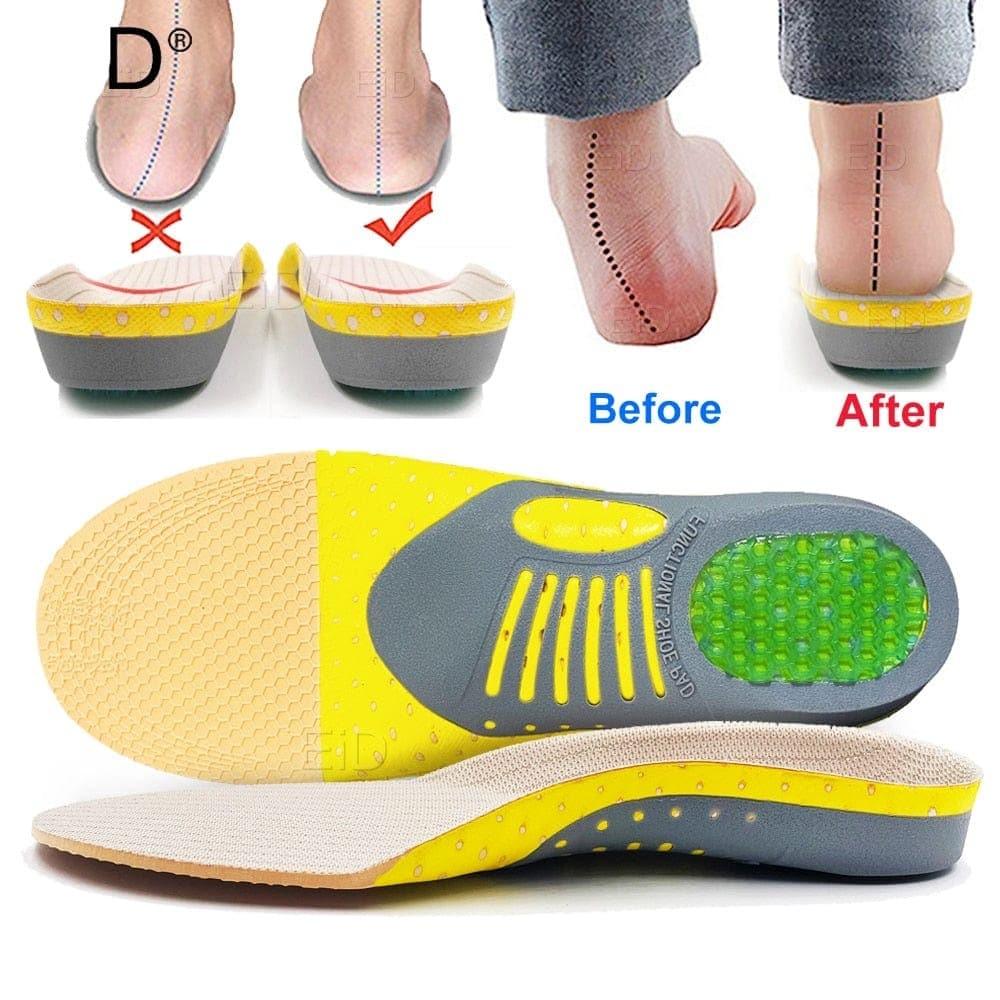 Orthotic Gel Insoles for Flat Feet & Plantar Fasciitis – 2 Piece