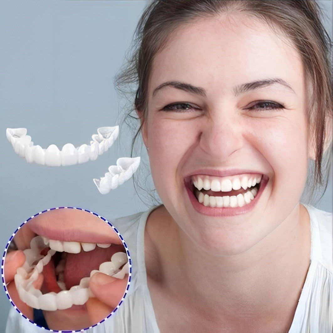 03 Smile Veneer (Upper & Lower Included)