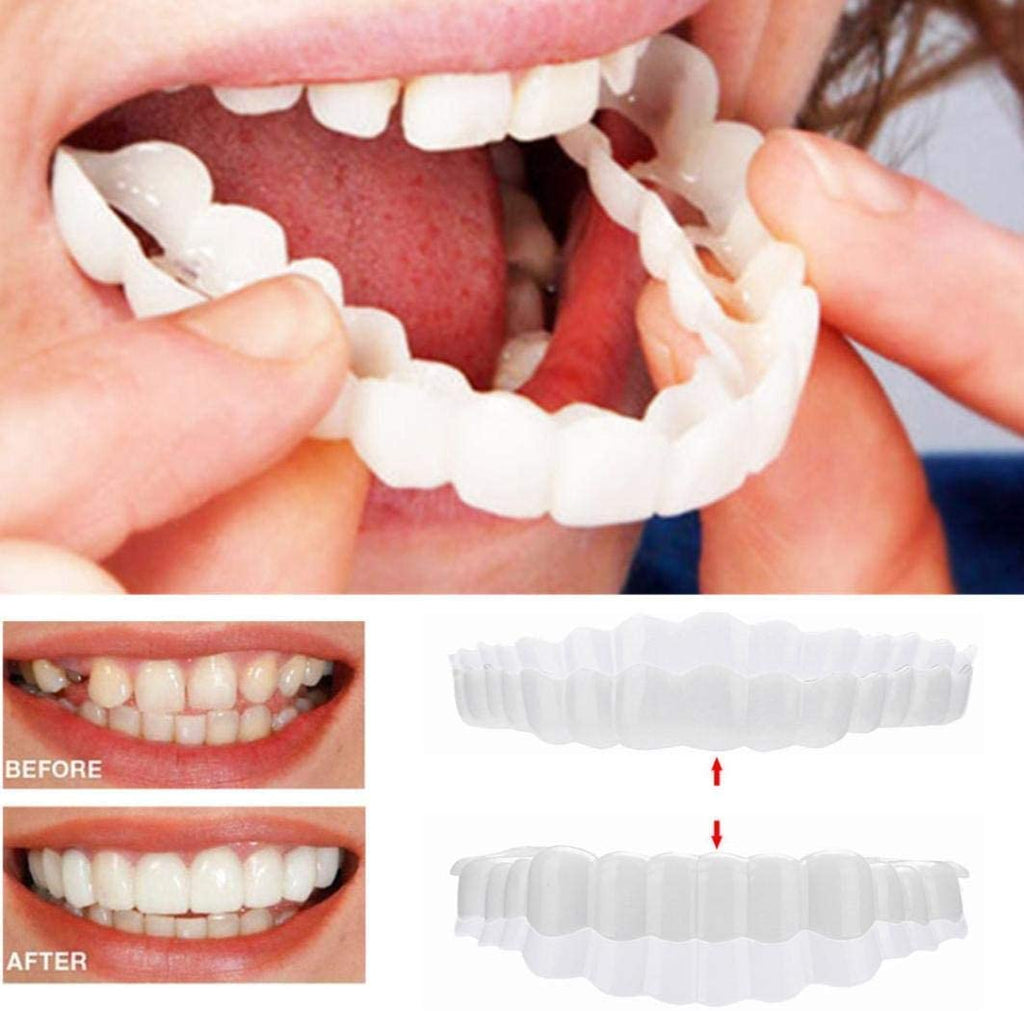 03 Smile Veneer (Upper & Lower Included)