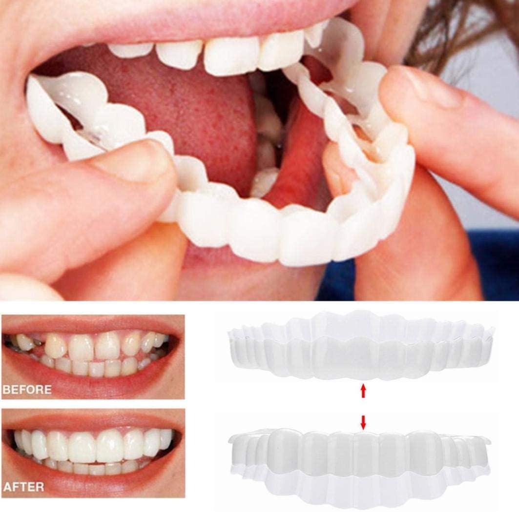 03 Smile Veneer (Upper & Lower Included)