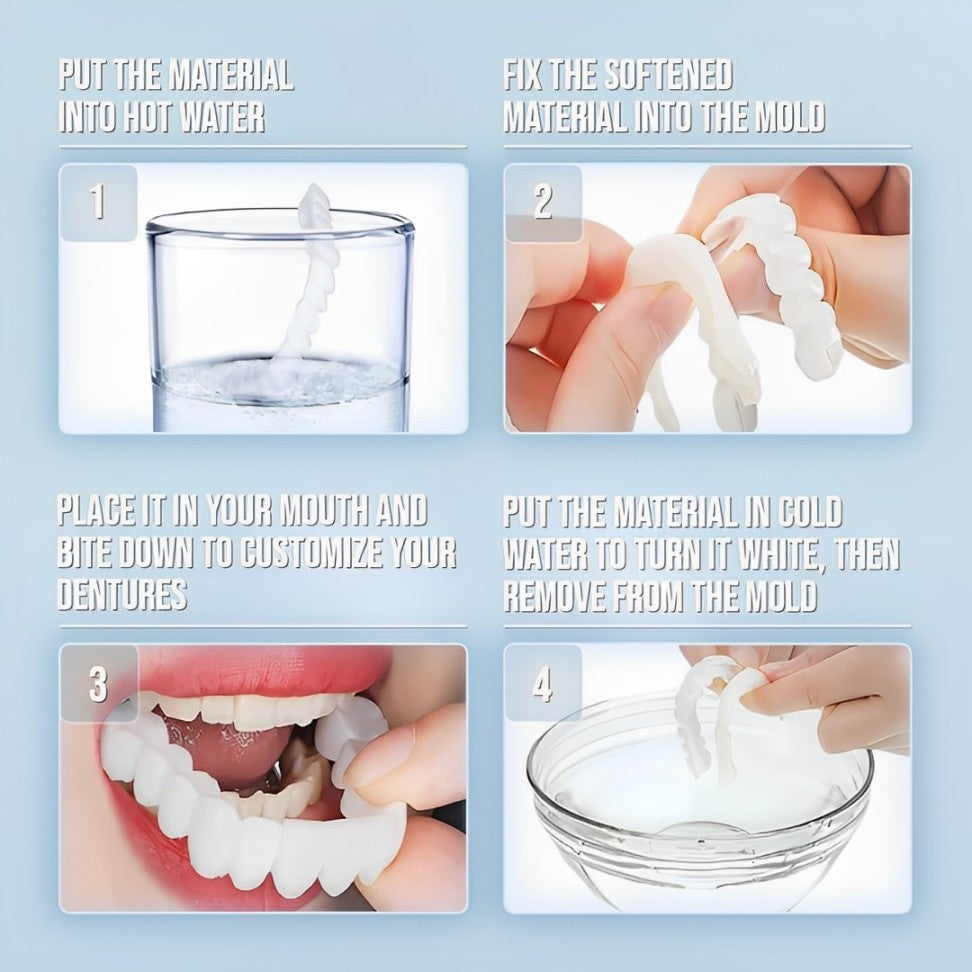 03 Smile Veneer (Upper & Lower Included)