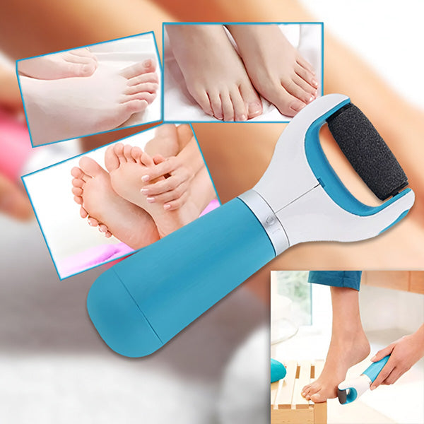 Electric Callus Remover for Smooth Feet