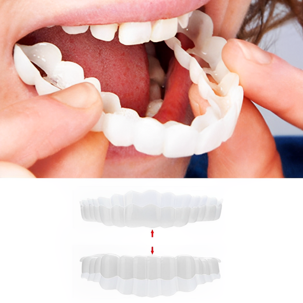 03 Smile Veneer (Upper & Lower Included)