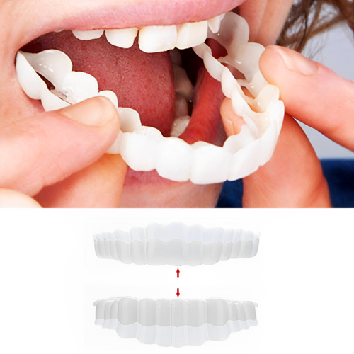 03 Smile Veneer (Upper & Lower Included)